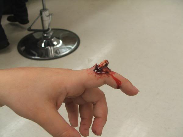 brokenfinger.jpg