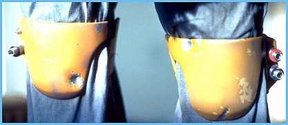 ESB knees (darts).jpg