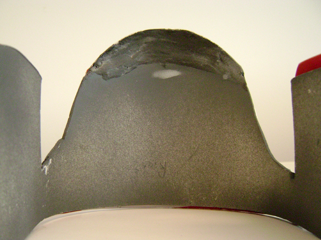 Inside-of-Knee-1.jpg