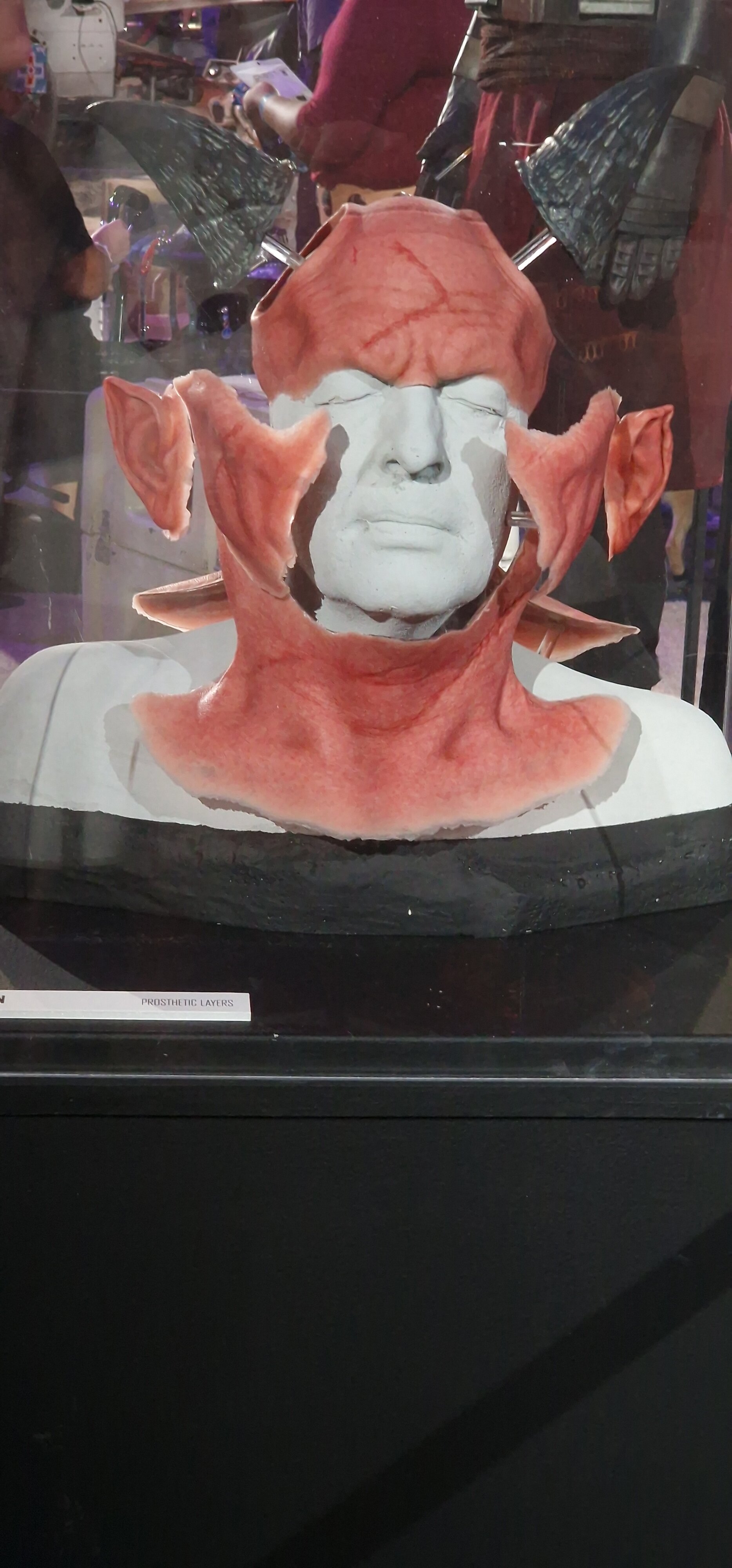 Burg Prosthetic Appliances 01.jpg