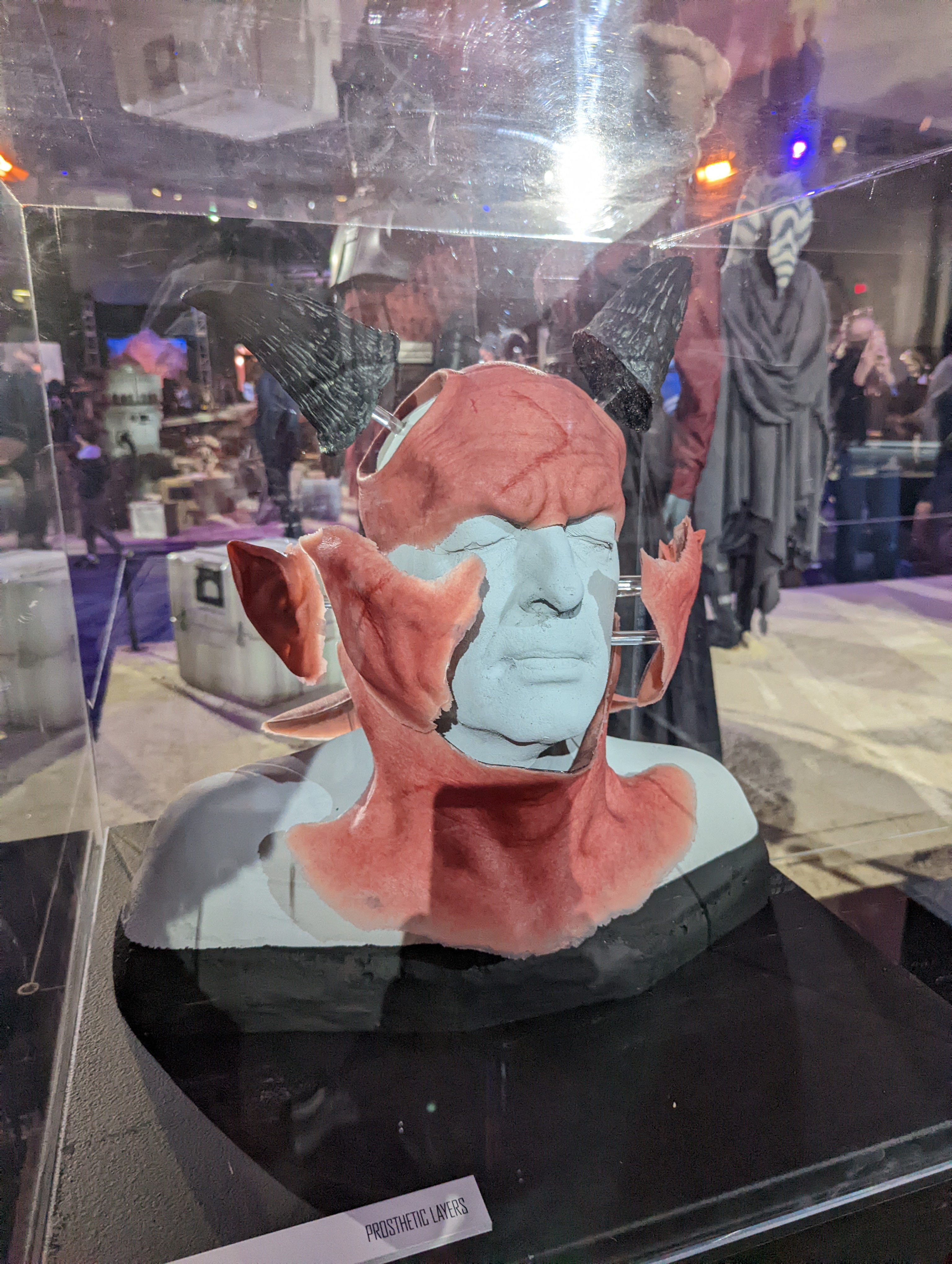 Burg Prosthetic Appliances 03.jpg