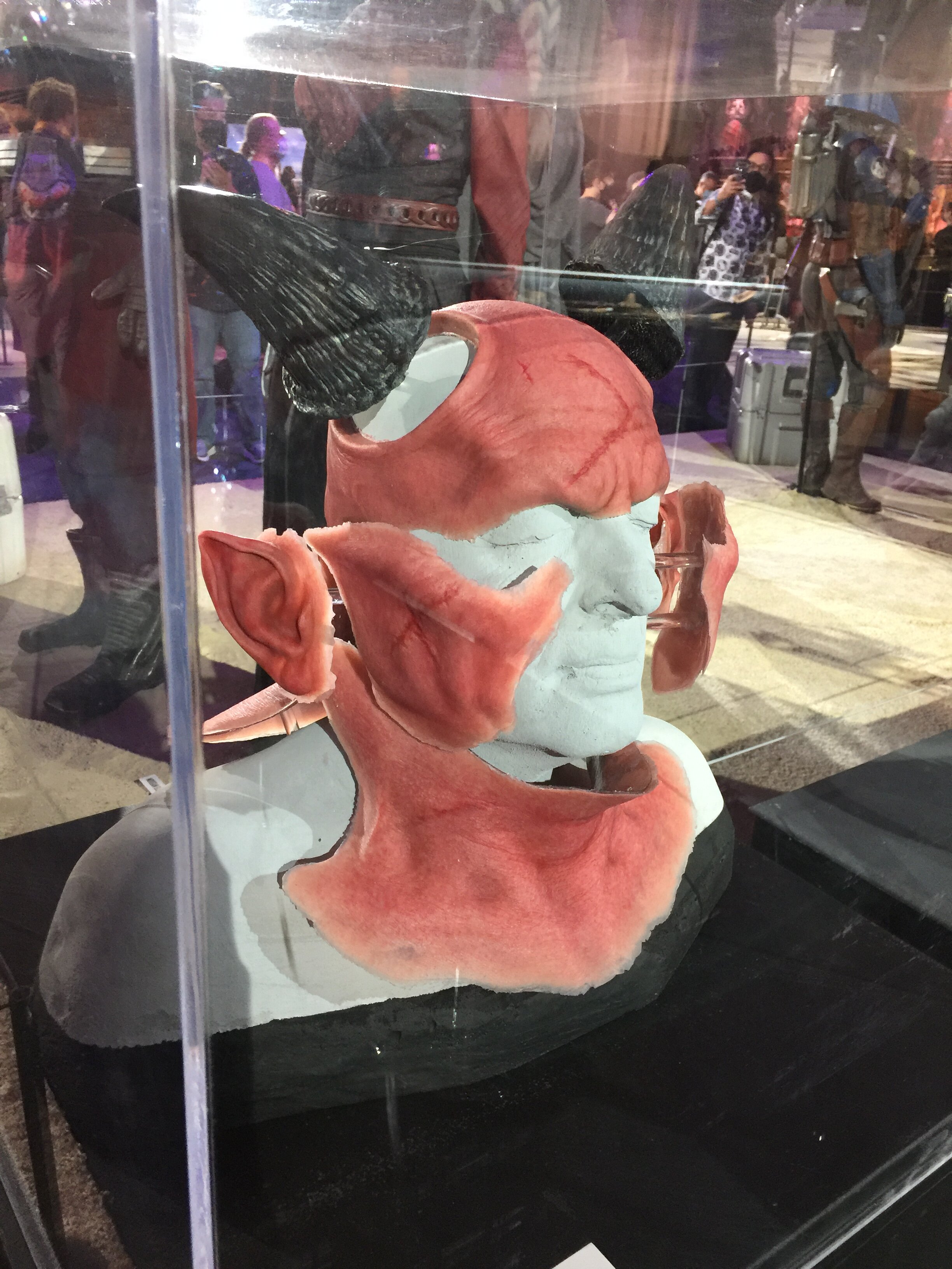 Burg Prosthetic Appliances 11.jpg